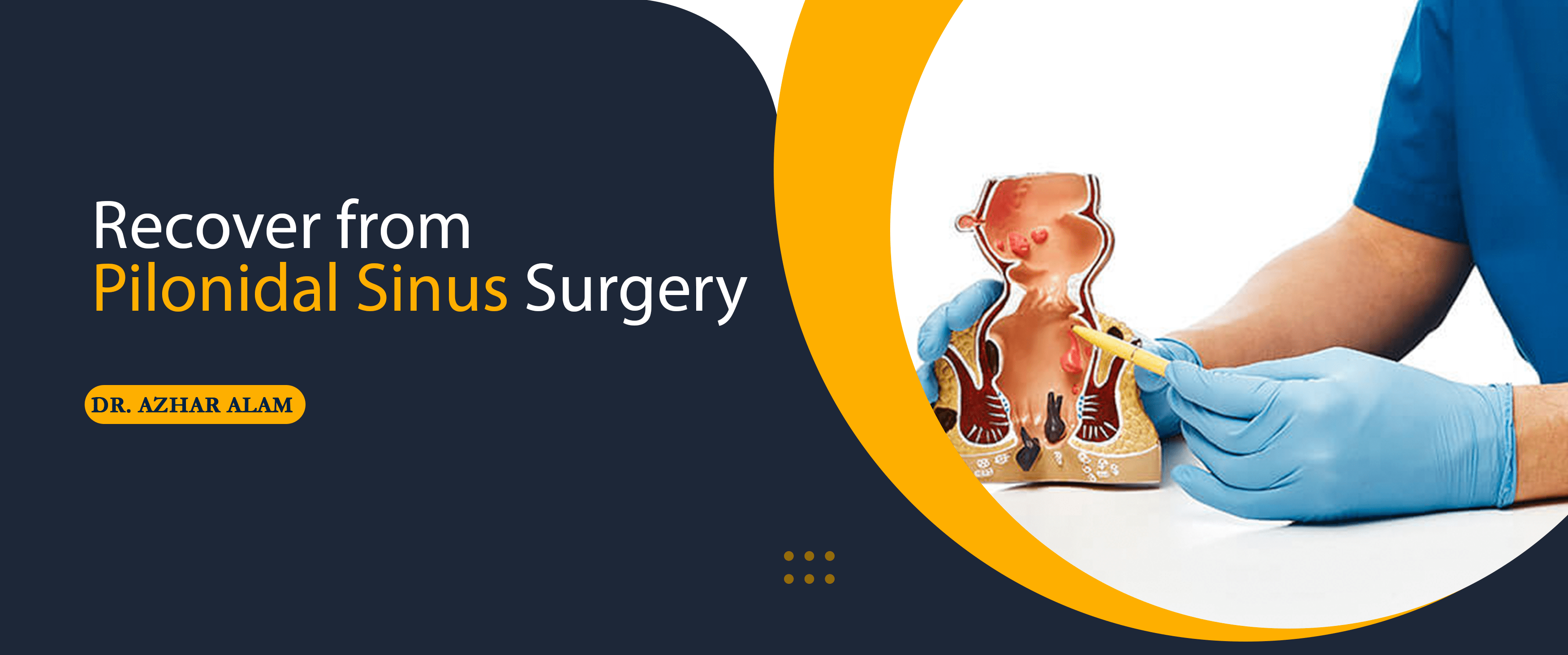 Recover from Pilonidal Sinus Surgery