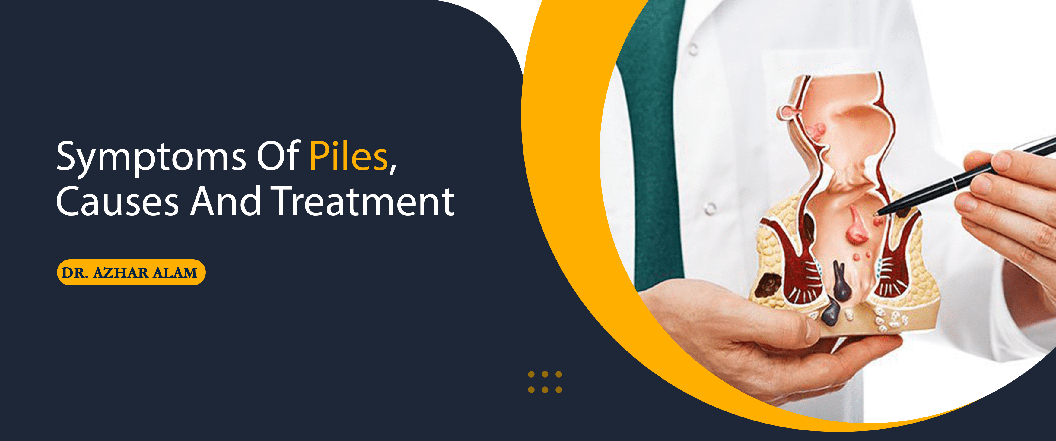 Piles - Symptoms, Meaning, Images, Causes and Types