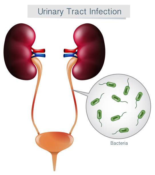 Urinary tract Infections