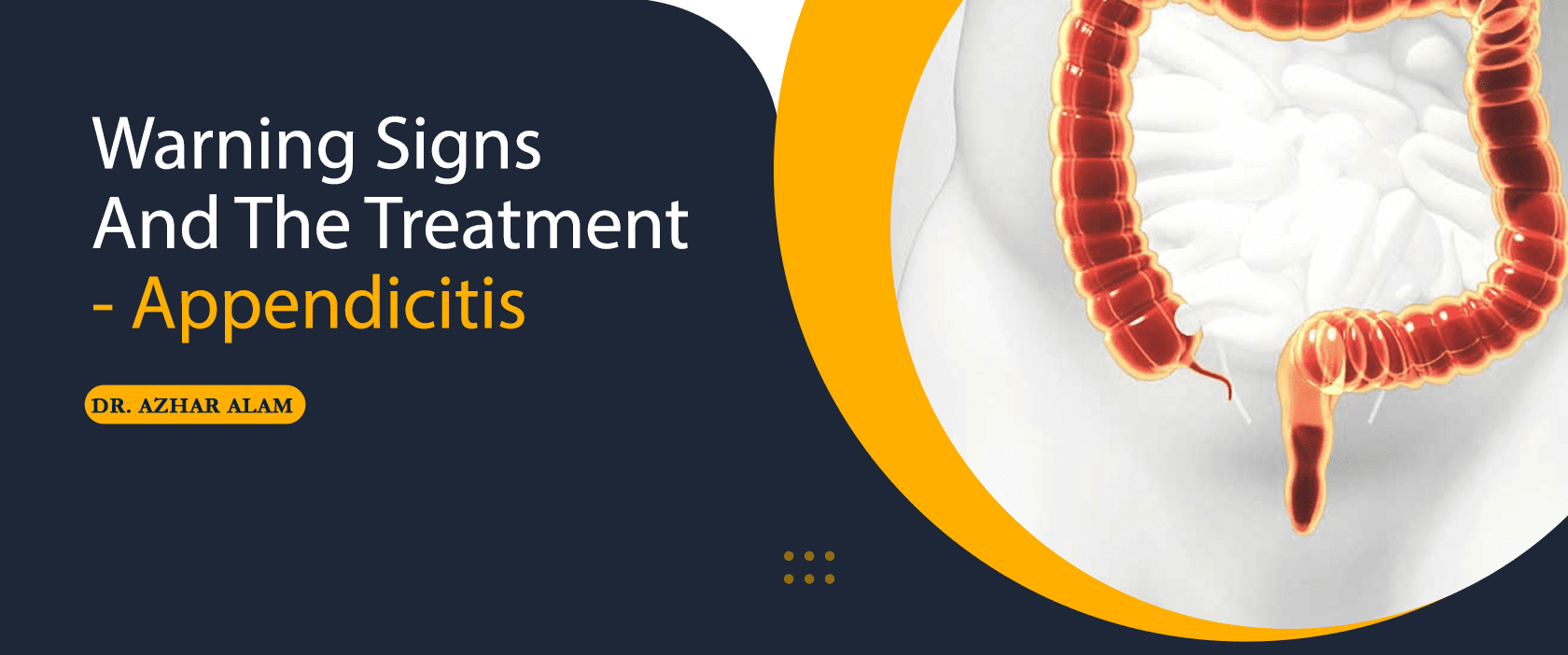 Warning Signs And The Treatment - Appendicitis