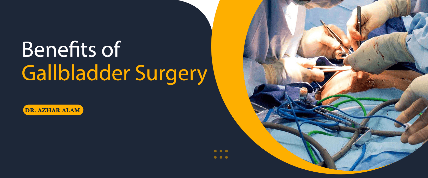 benefits of gallbladder surgery