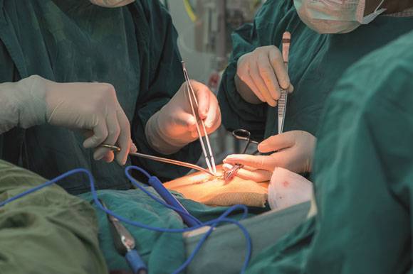 fissures-laser-surgery