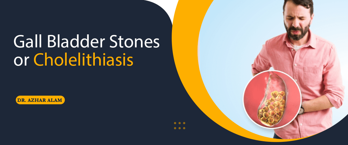 Gall Bladder Stones/ Cholelithiasis