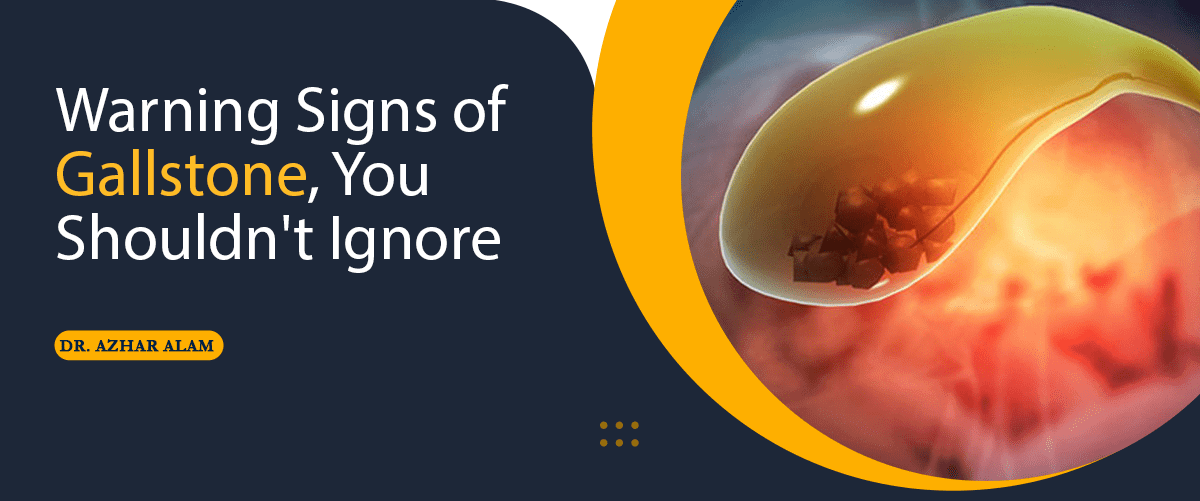 Warning Signs of Gallstone, You Shouldn't Ignore