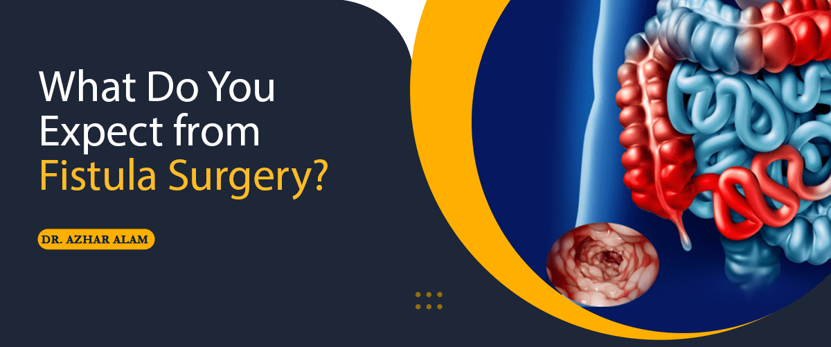 What Do You Expect from Fistula Surgery