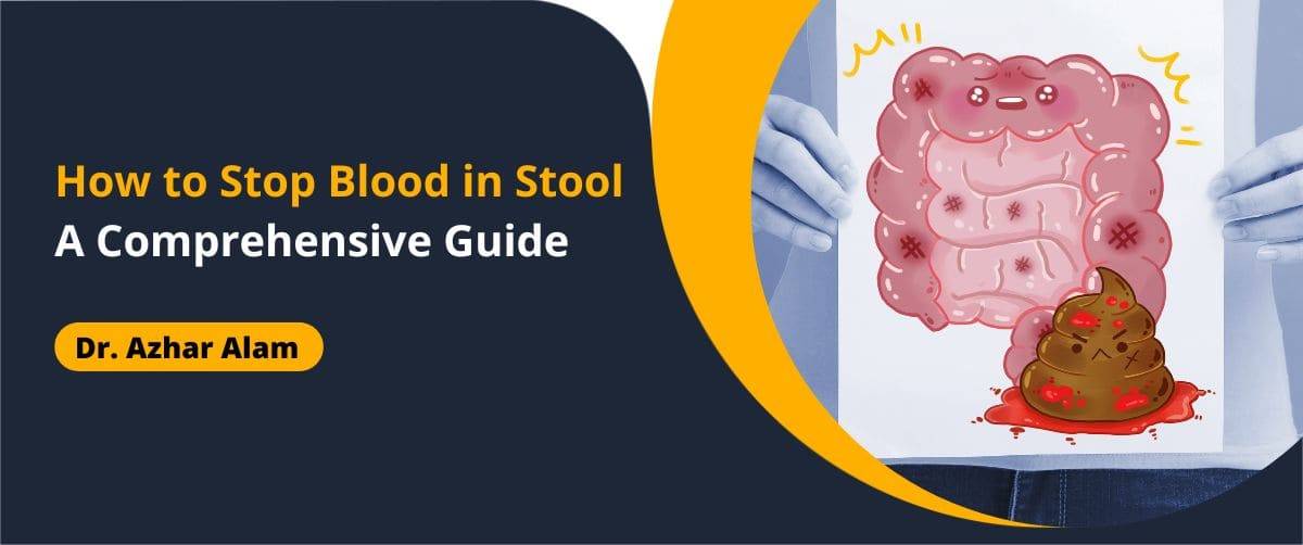 How to Stop Blood in Stool A Comprehensive Guide - Dr Azhar Alam