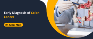 Early Diagnosis of Colon Cancer