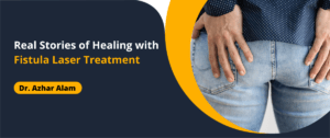 Healing with Fistula Laser Treatment