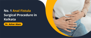 No. 1 Anal Fistula surgery in Kolkata