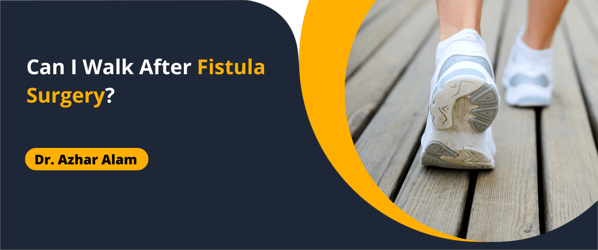 Can I Walk After Fistula Surgery